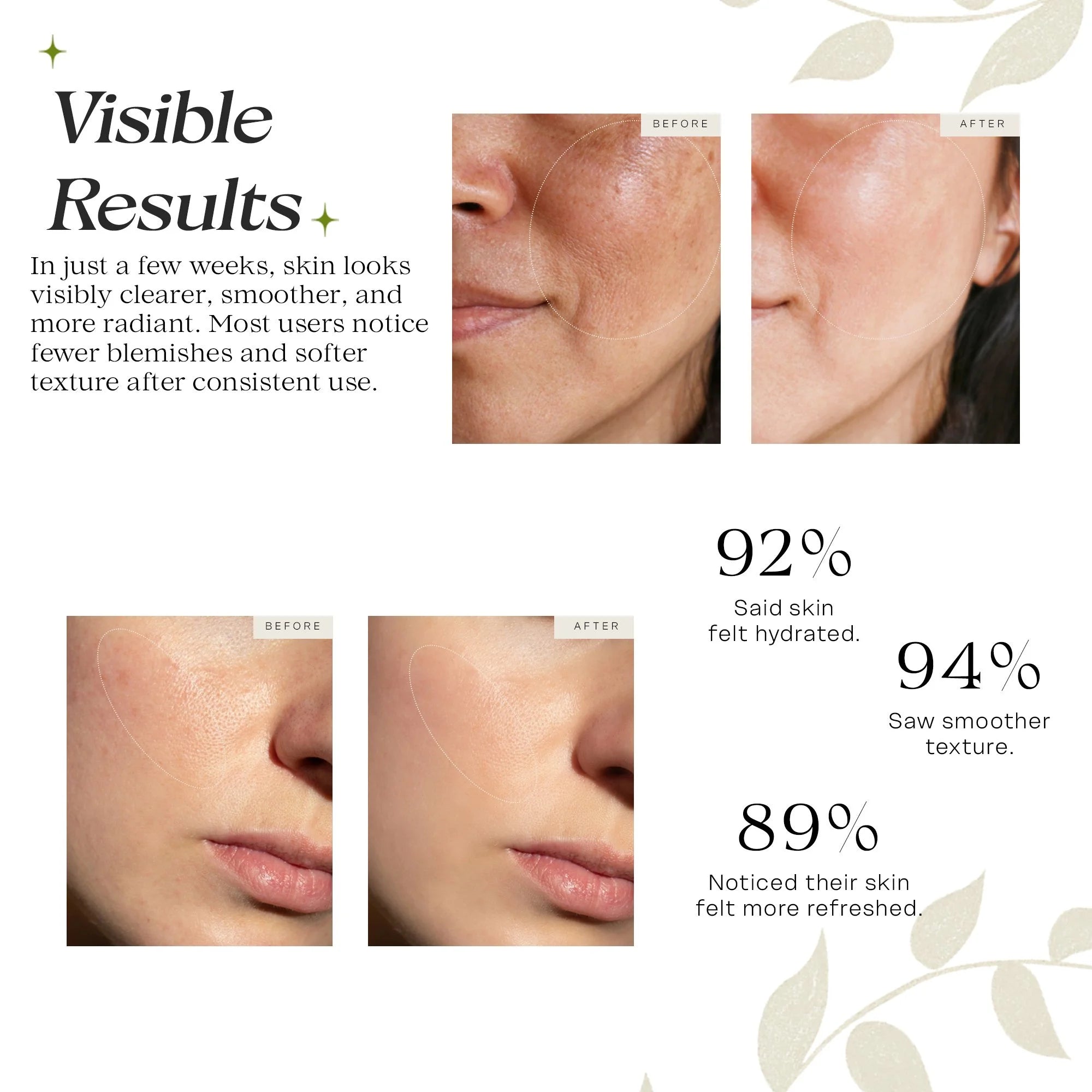 Pure Glow Acne Rescue Kit